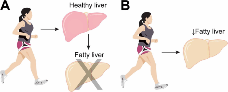 The Livers Job and Why Exercise Matters